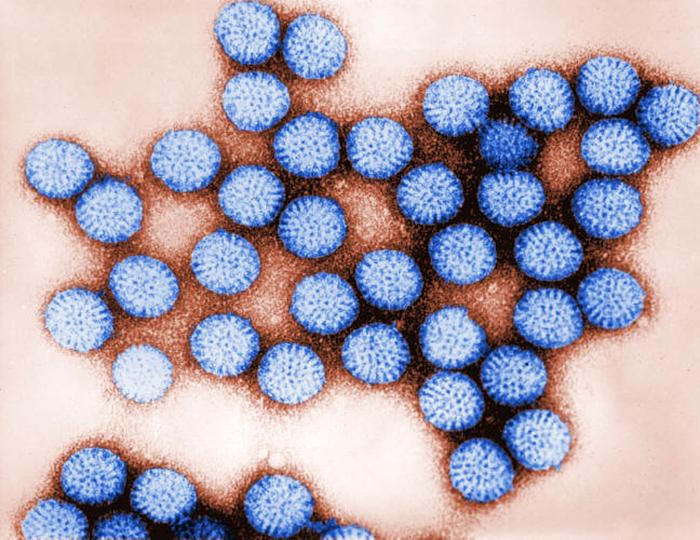 tiêu chảy cấp do Rotavirus